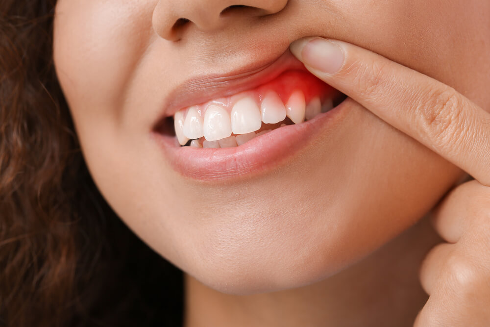 Woman with gum inflammation