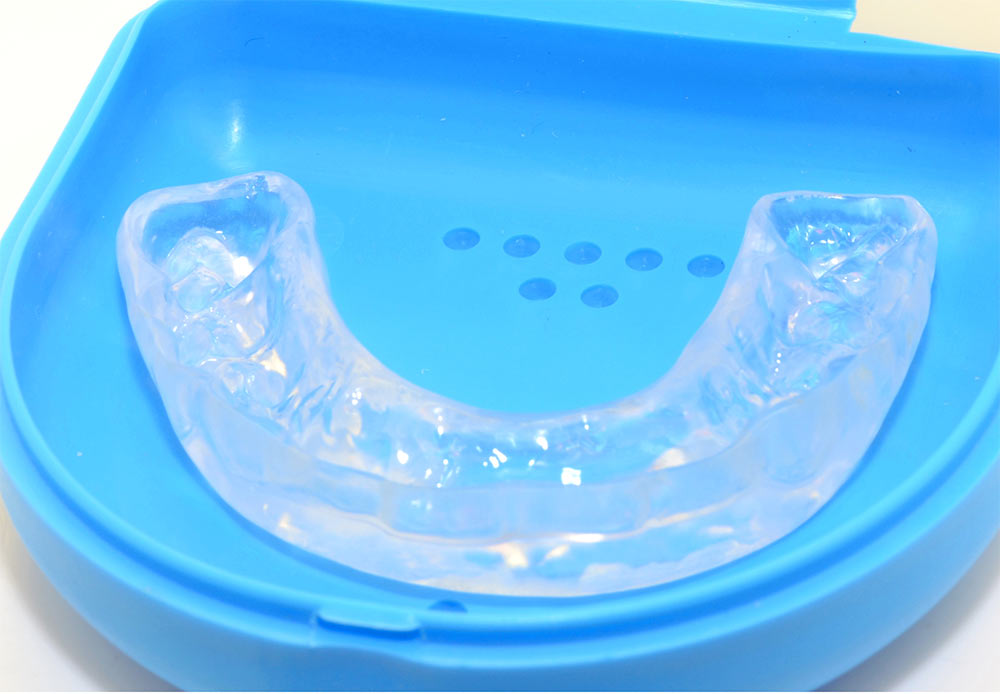 Transparent dental aligner