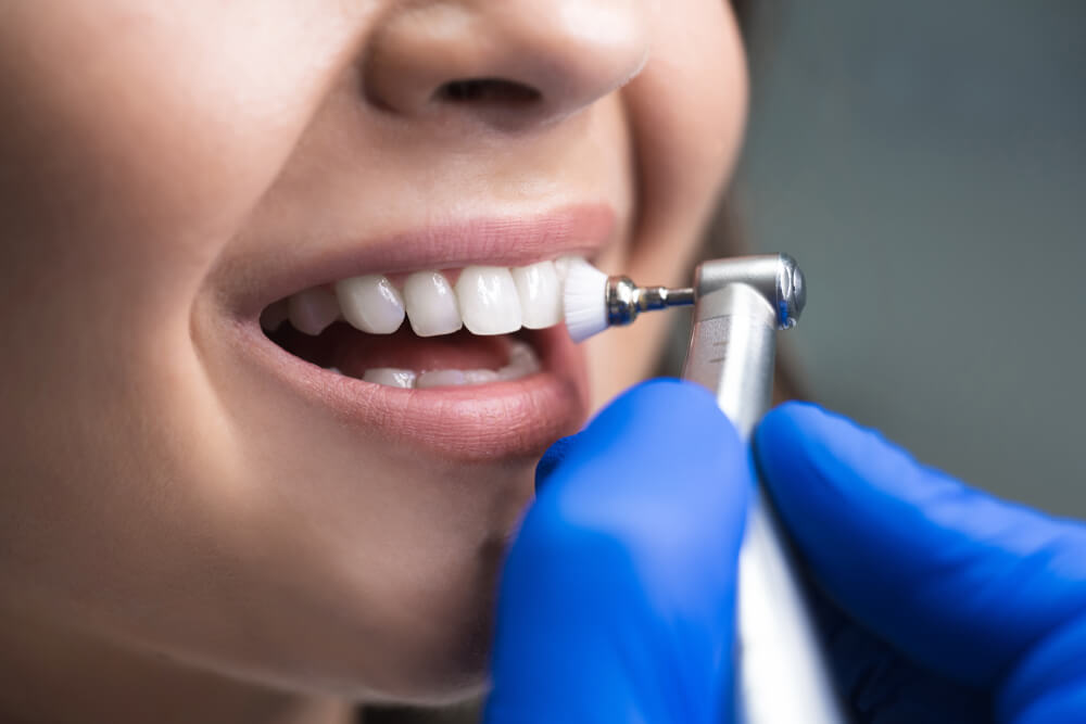 A woman having her teeth cleaned by a dental hygienist