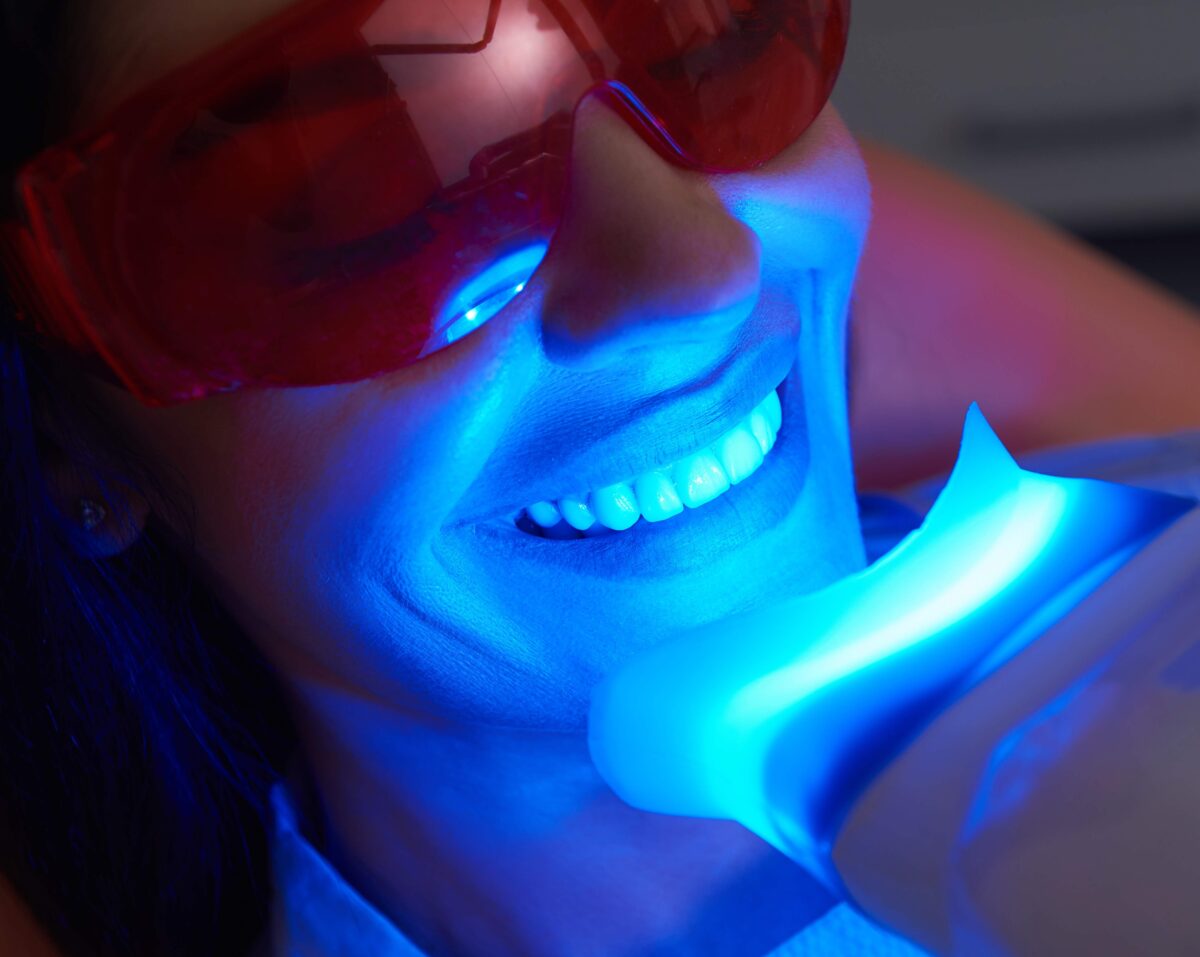 Professional Teeth Whitening in North Fort Myers, FL